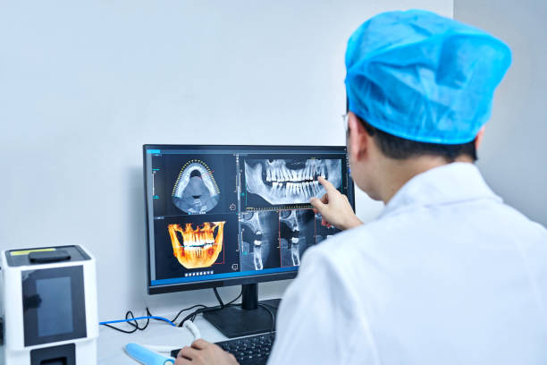 Best Emergency Wisdom Tooth Extraction in Stephenville, TX