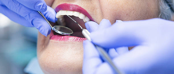 Best Broken or Chipped Tooth Repair in Stephenville, TX