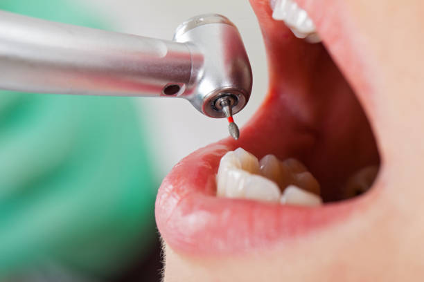 Best Emergency Orthodontic Repairs in Stephenville, TX
